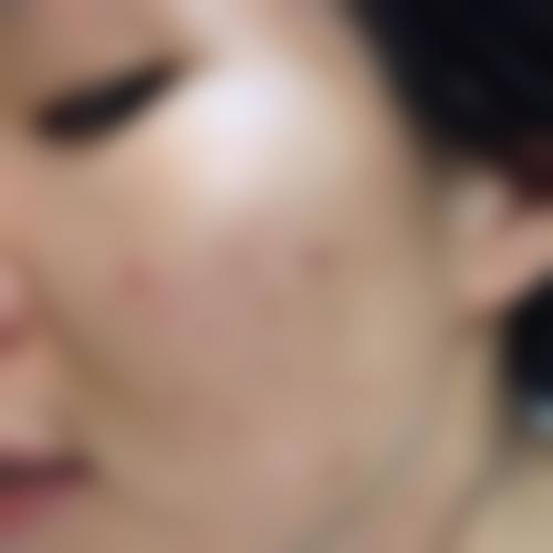 八、贵阳市妇幼保健院(医学美容科)真实的患者评价