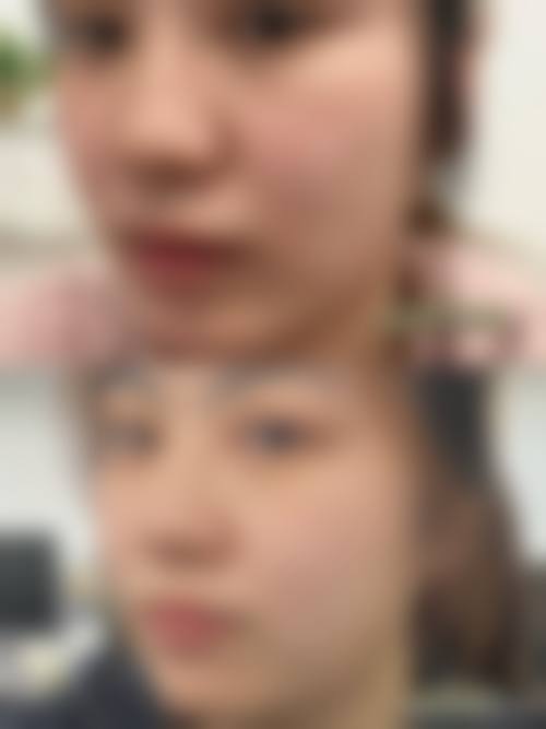 八、武汉大学人民医院整形科真实的患者评价