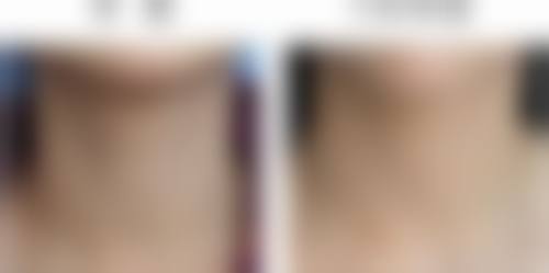 二、南京熙涵医疗美容门诊部怎么样？