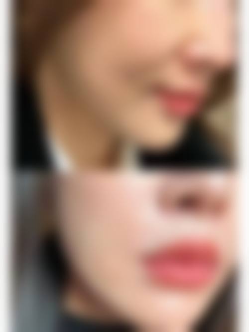 六、武汉大学人民医院整形科地址及交通