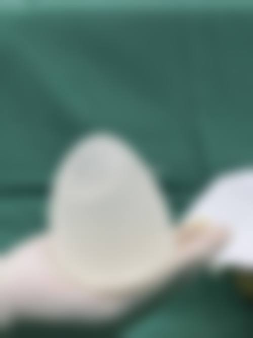 四、西安悦昕颜医疗美容门诊部特色项目