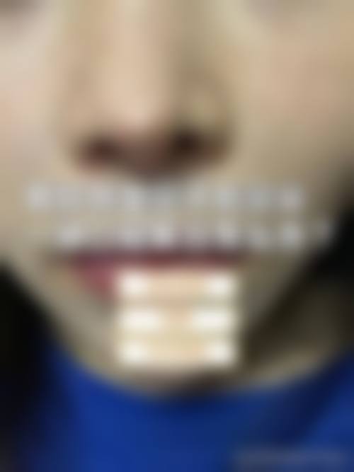 七、武汉大学人民医院整形科预约方式