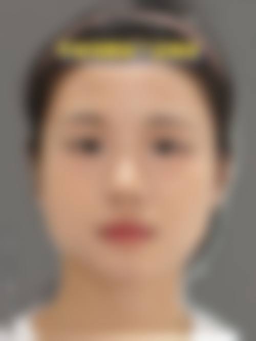 八、合肥佳壹美整形医院预约方式