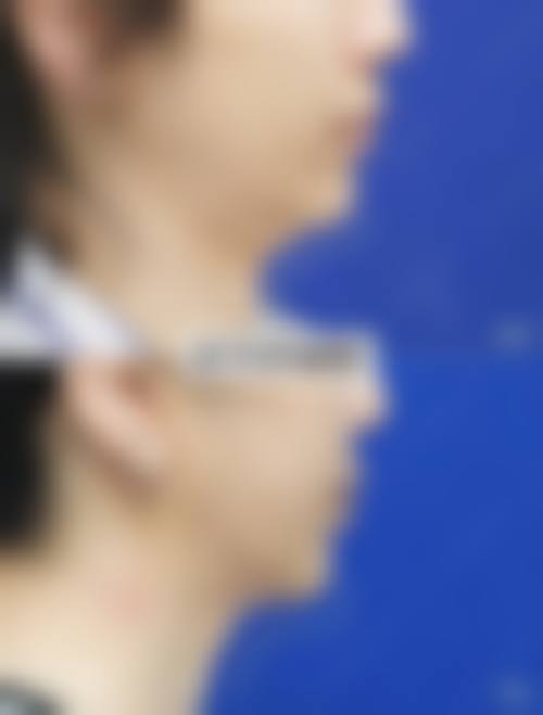 四、东莞南城医美恩整形医院特色项目