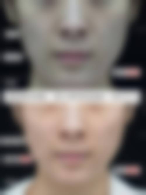 六、合肥佳壹美整形医院价格表