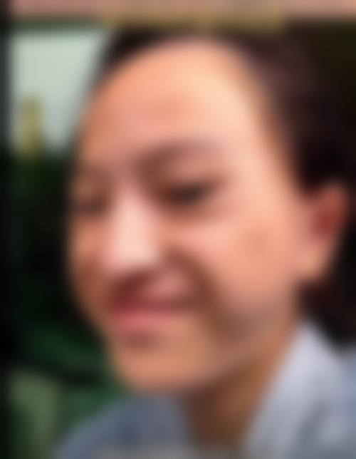 二、西安悦昕颜医疗美容门诊部怎么样？