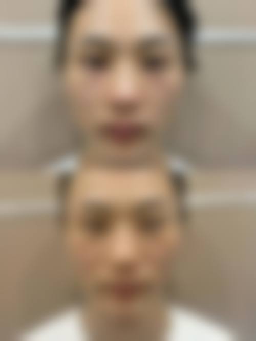 五、复旦大学附属中山医院青浦分院(整形外科)价格表