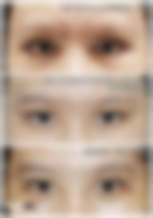 四、南京熙涵医疗美容门诊部特色项目