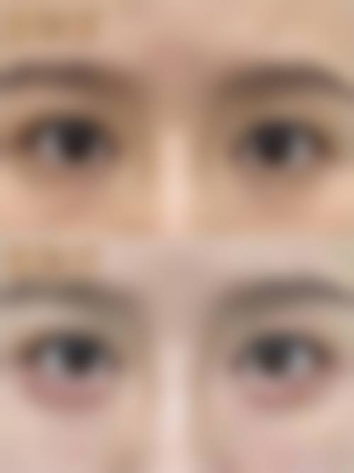 二、郑州伊莱美医疗美容怎么样？