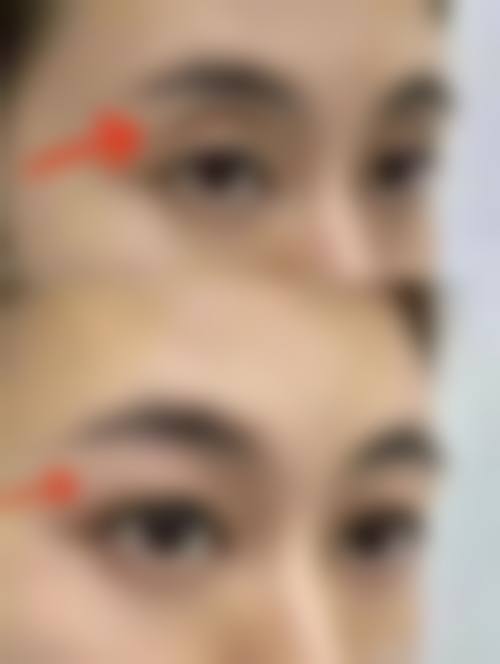 四、佛山德玛肤医疗美容诊所特色项目