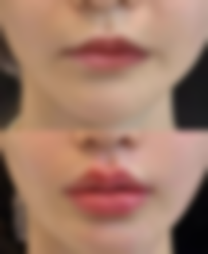 三、东莞南城医美恩整形医院诊疗项目有哪些?