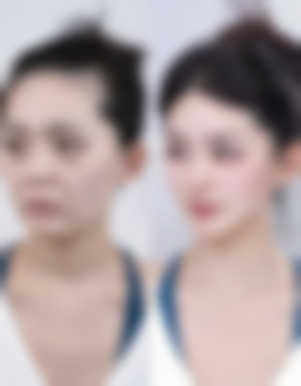 六、郑州伊莱美医疗美容价格表