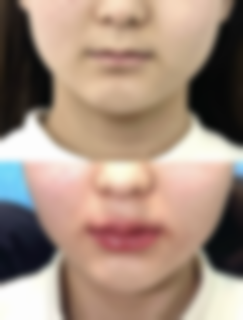 四、真实实例成效揭秘