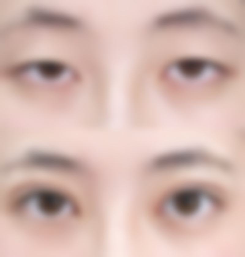 四、广东医学校附属医院整形外科特色项目