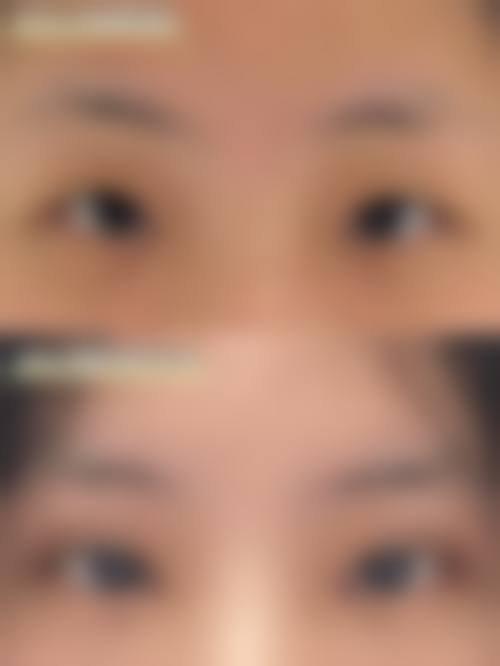 八、克拉玛依艺启美整形医院真实的患者评价