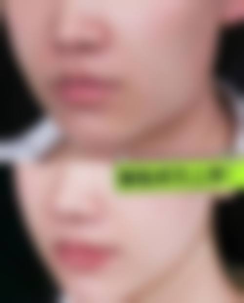 八、济宁颜美医疗美容诊所真实的患者评价