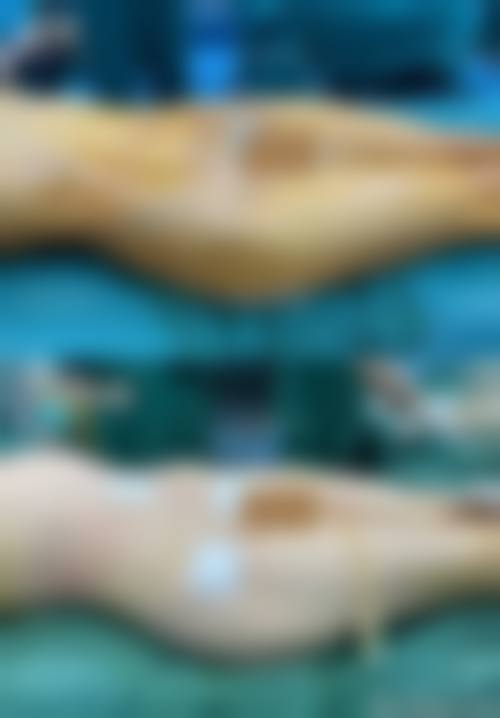 五、昆明医然心(思尔美)医疗美容诊所价格表