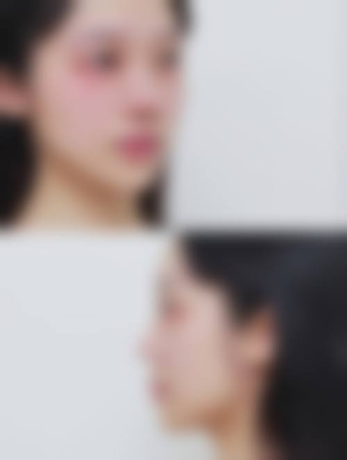 四、平顶山安一峰医学美容医院特色项目