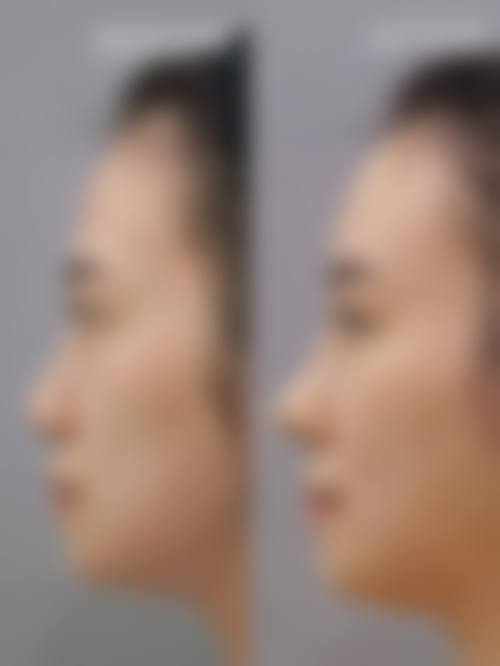 五、平顶山安一峰医学美容医院价格表