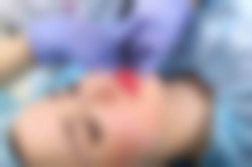 八、韩国Able医疗美容医院真实的患者评价