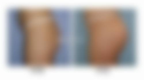 八、韩国The Walts皮肤科真实的患者评价