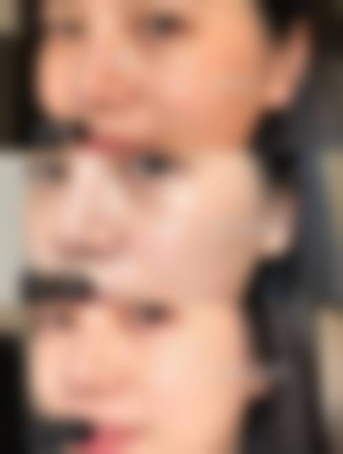 五、宿迁华美创和整形美容医院价格表