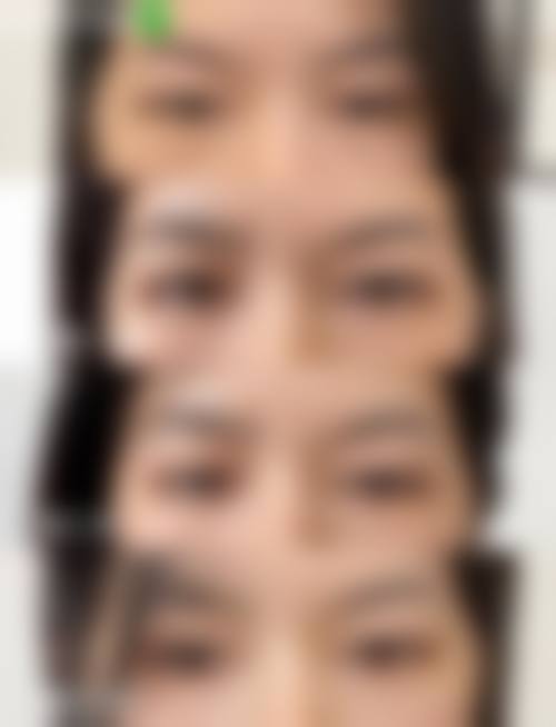 八、厦门思明洛依初颜整形医院真实的患者评价