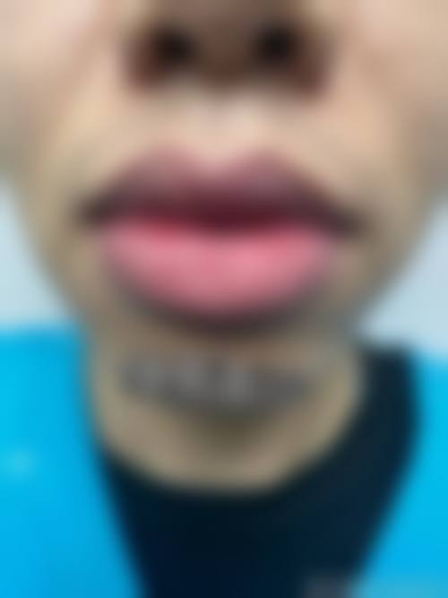 七、眉山好一点医疗美容诊所预约方式