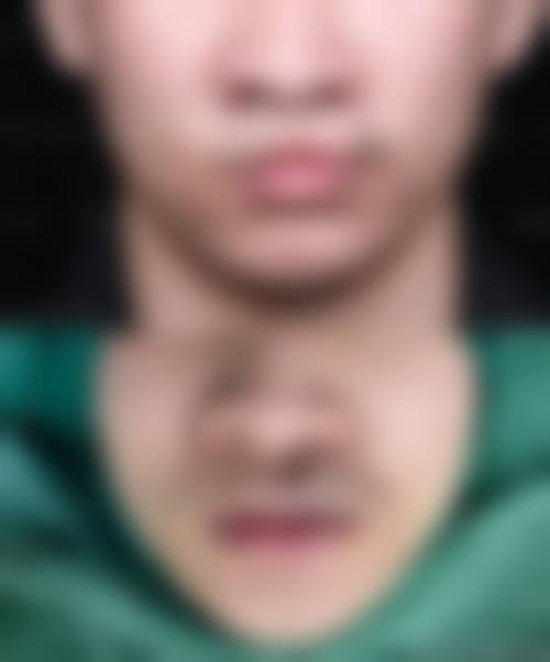 四、厦门思明洛依初颜整形医院特色项目