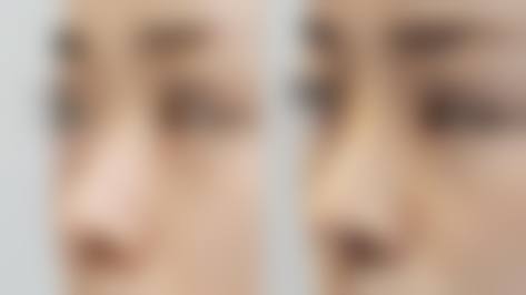 四、济宁颜美医疗美容诊所特色项目