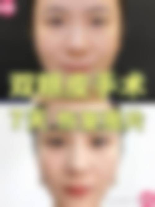 八、黑龙江大庆倾颜医疗美容门诊部预约方式