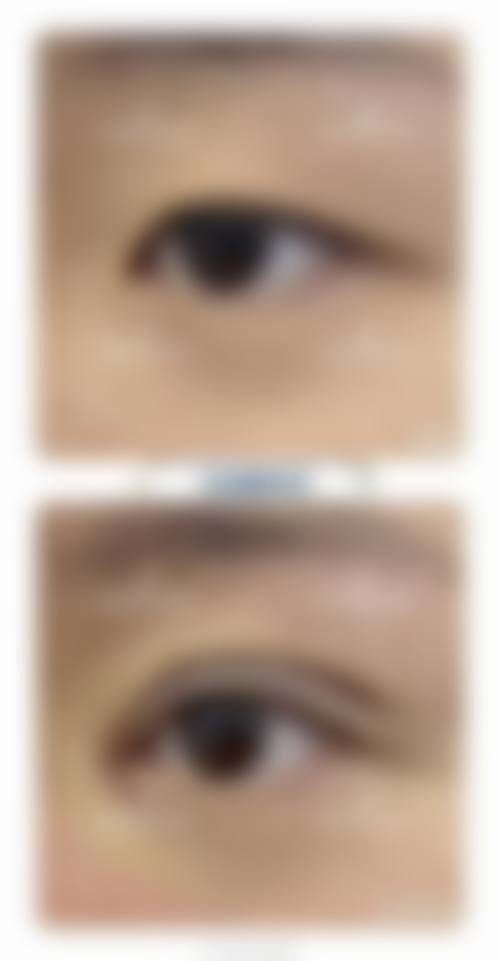 八、唐山路南安娜柯琳医疗美容诊所真实的患者评价