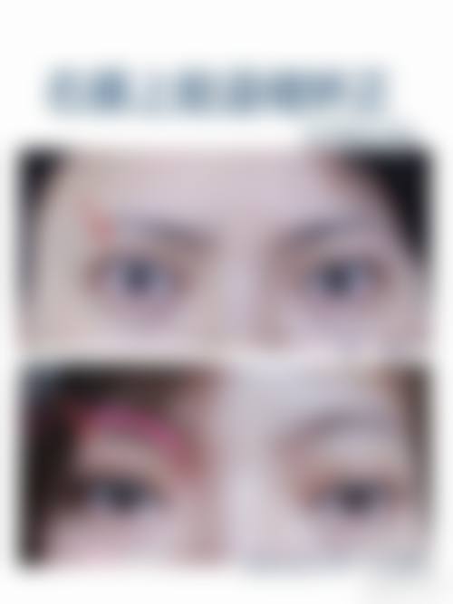 二、平顶山安一峰医学美容医院怎么样？