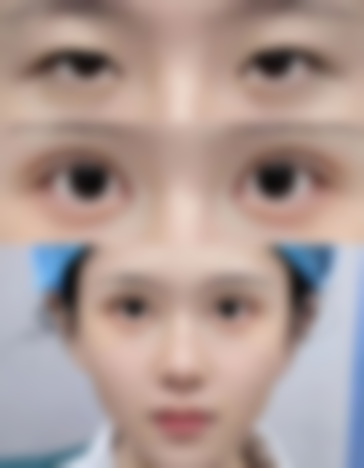 九、温州欧歌医疗美容门诊部真实的患者评价