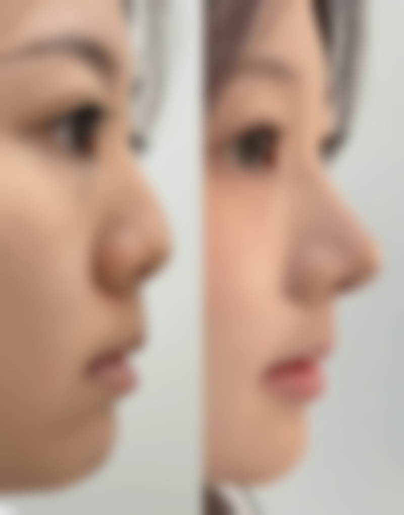 三、安徽医 科 大学第四附属医院烧伤整形外科诊疗项目有哪些?