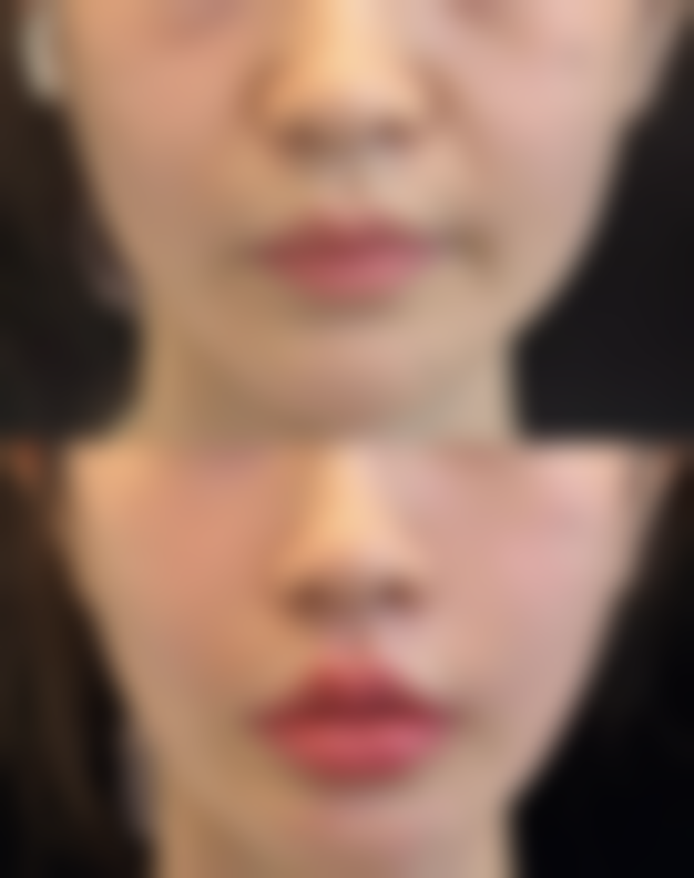 七、韩国Able医疗美容医院预约方式
