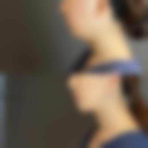 四、镇江韩缇娜整形医院特色项目