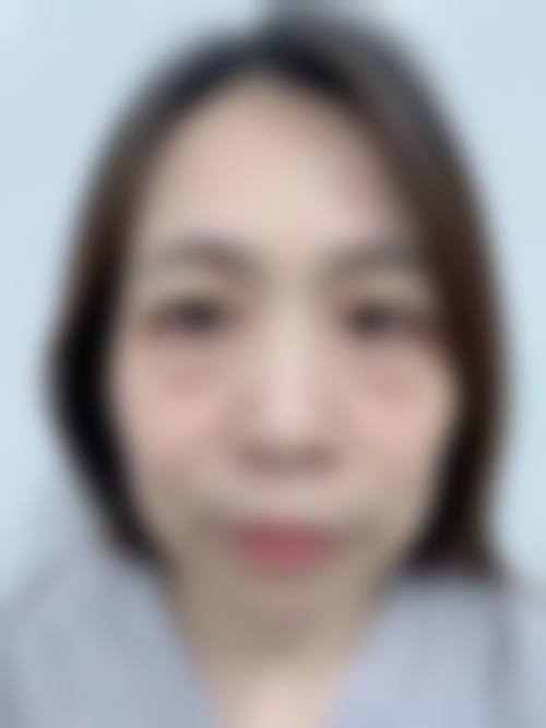 四、六安颜如玉医疗美容诊所特色项目