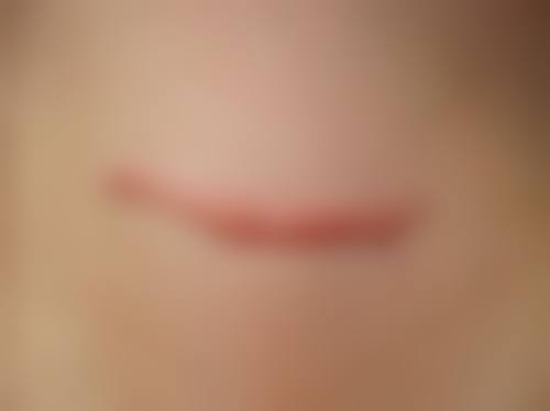 九、珠海市慢性病防治中 心美容部真实的患者评价