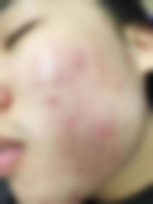 三、珠海市慢性病防治中 心美容部诊疗项目有哪些?