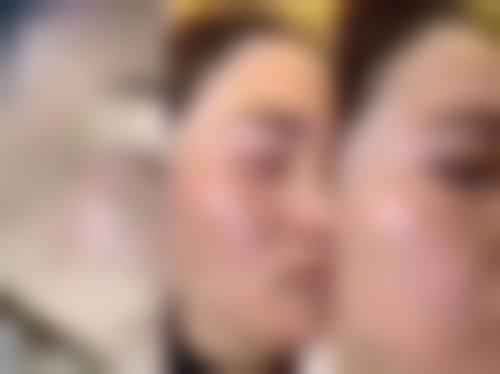 八、济南佳年华医疗美容诊所真实的患者评价