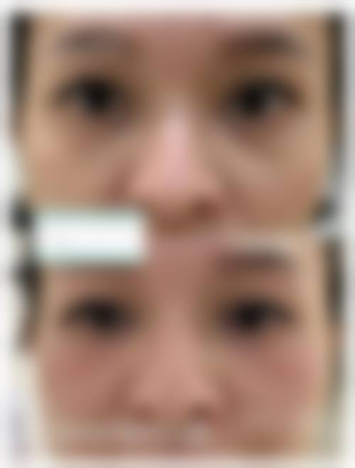 九、雄安王妃医疗美容医院真实的患者评价