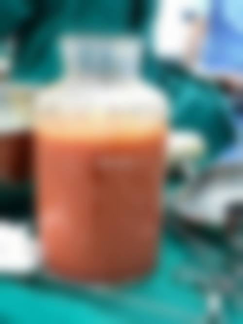 五、镇江韩缇娜整形医院价格表