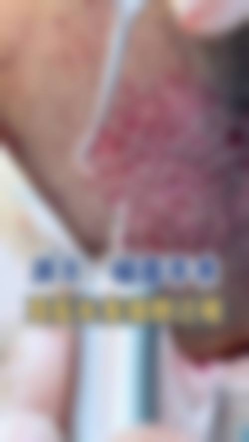 八、六安颜如玉医疗美容诊所真实的患者评价