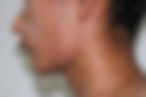 九、大连宝利整形医院真实的患者评价