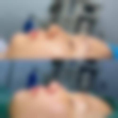 五、宁波鄞州百信瑞元整形医院价格表