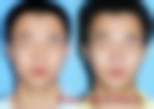 六、雄安王妃医疗美容医院价格表