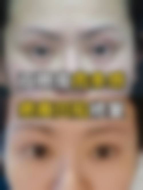 池州灵创医美医疗美容医院真实的患者评价