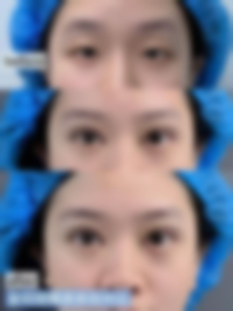 四、胶州姬美荟医疗美容诊所特色项目