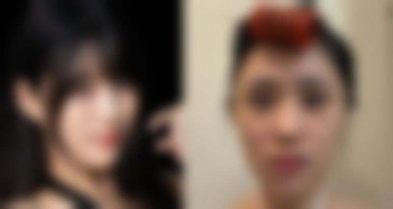 三、日本Ritz（广比利次）美容外科医院诊疗项目有哪些？